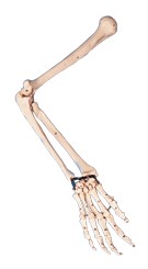手臂骨模型A11124