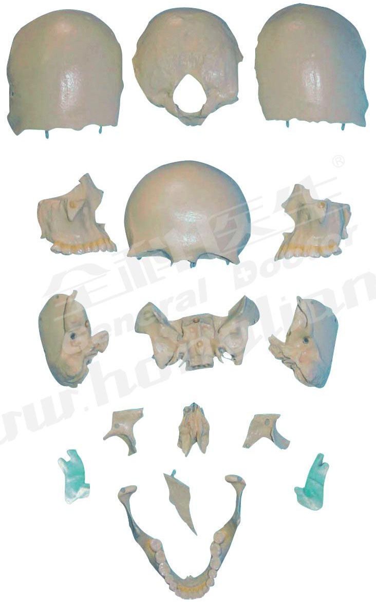 部分颅骨散骨模型A11117/2 