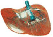 透明肝模型A12010