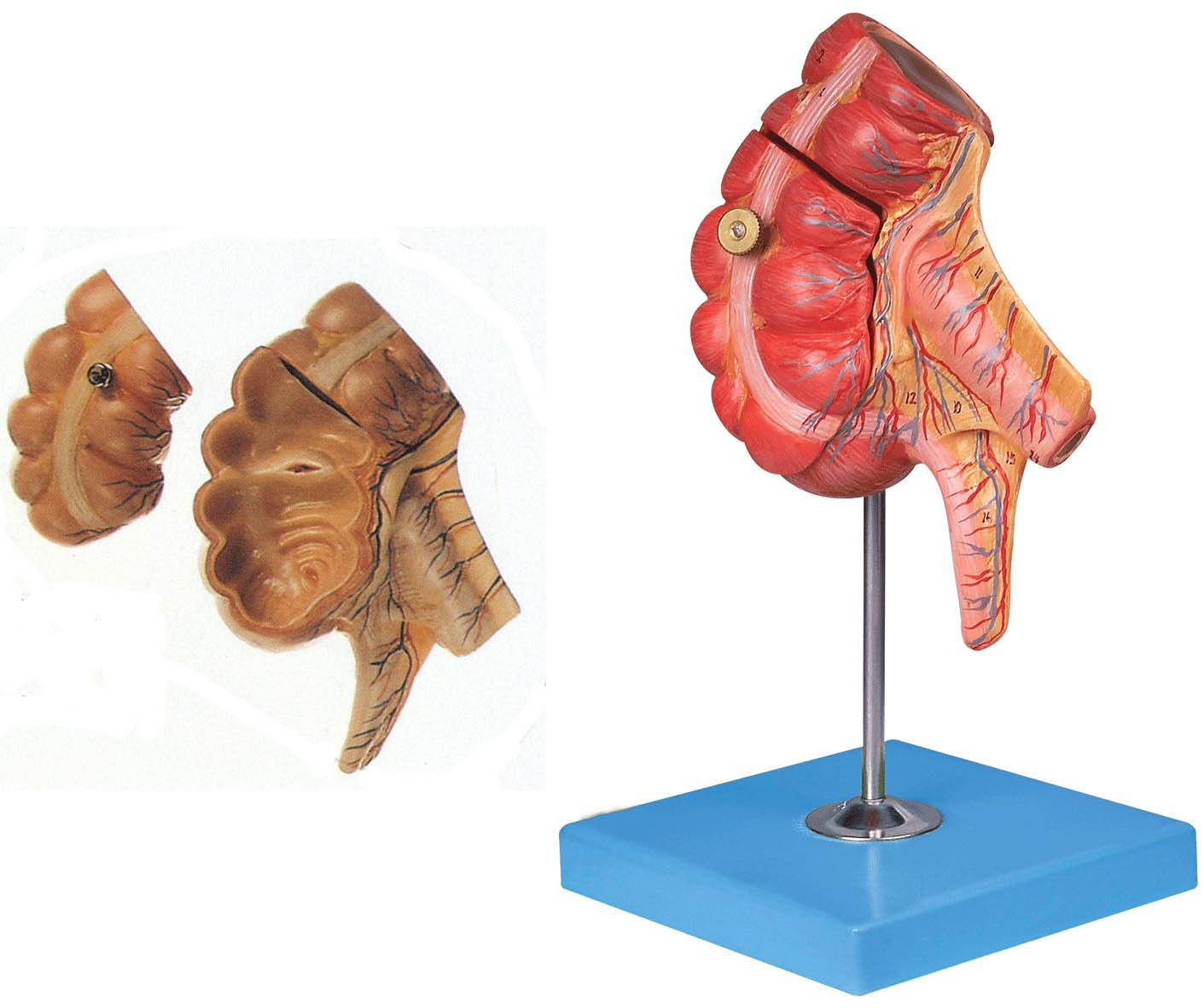 盲肠和阑尾模型A12006