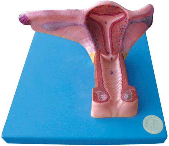 女性内生殖器官模型A15108 