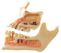 牙体病变模型B10016 