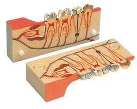 牙分解组织模型B10007 