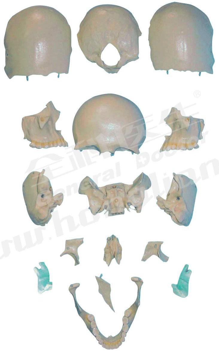 部分颅骨散骨模型A11117，分离头颅骨散骨模型