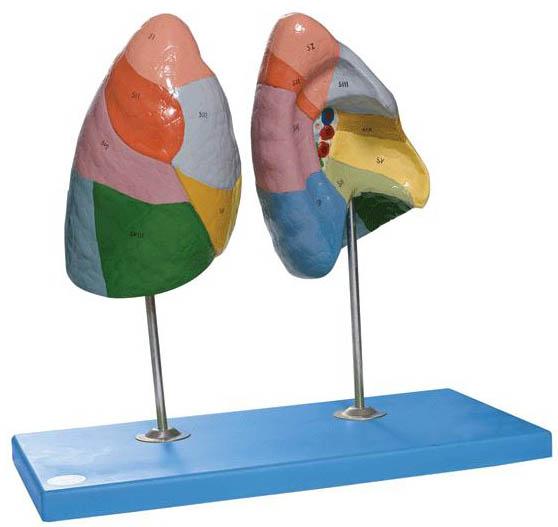 肺段模型A13010，肺动脉段膨隆-找上海佳悦，专业生产医学模型生产厂家