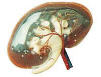 透明肾脏放大模型A14008 ，肾脏模型-找上海佳悦，专业医学模型生产厂家