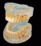 透明牙体病理模型B10011-是我公司自行研发生产热销的医学教学模型,欢迎各医院单位订购021-63283651