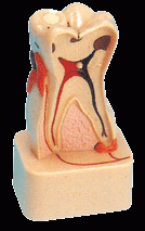 牙齿病变综合病理分解模型B10008-是我公司自行研发生产热销的医学教学模型,欢迎各医院单位订购021-63283651