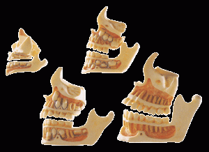 牙与颌骨的发育模型-是我公司自行研发生产热销的医学教学模型,欢迎各医院单位订购021-63283651