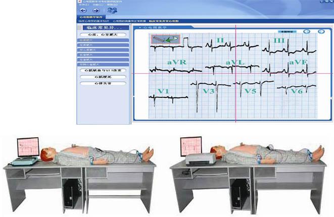 高智能数字网络化心电图模拟教学系统